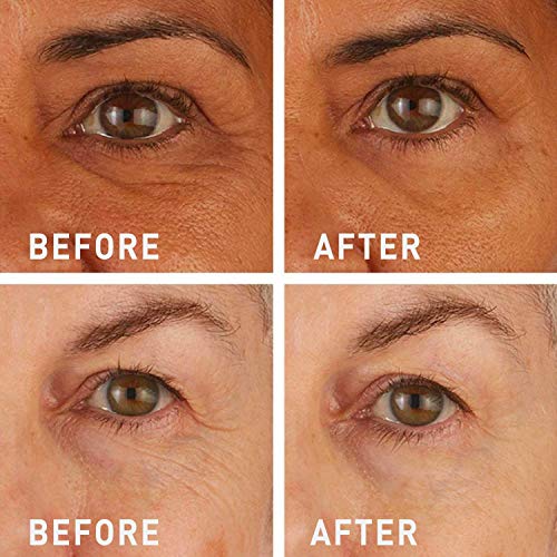 skyn ICELAND Hydro Cool Firming Eye Gels: Under-Eye Gel Patches to Firm