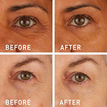 
                        
                          गैलरी व्यूवर में इमेज लोड करें, skyn ICELAND Hydro Cool Firming Eye Gels: Under-Eye Gel Patches to Firm
                        
                      