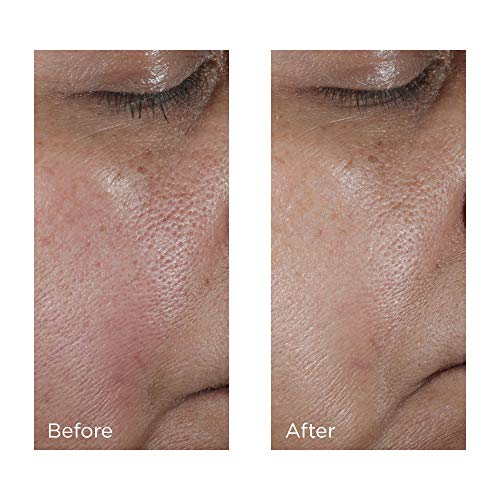 Perricone MD No: Rinse Intensive Pore Minimizing Toner 4 Oz