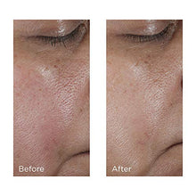 
                        
                          Load image into Gallery viewer, Perricone MD No: Rinse Intensive Pore Minimizing Toner 4 Oz
                        
                      